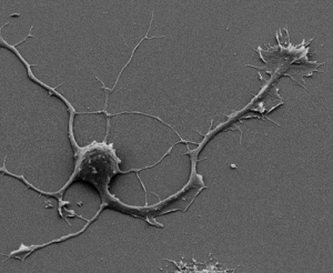 Scanning electron microscopy of a neuron